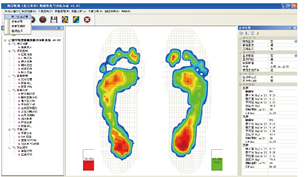 足底压力分布测试系统
